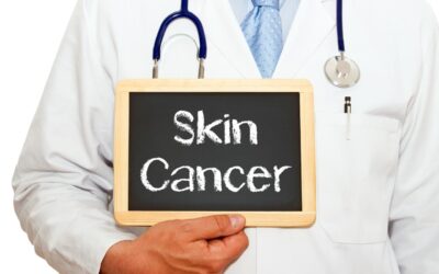 Can Skin Cancer Be Prevented Entirely? Insights from Dermatology Experts